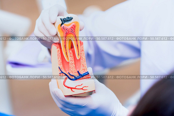 Dentist with tooth implant false teeth. Dentistry and healthcare concept at dental clinic. Стоковое фото, агентство Ingram Publishing / Фотобанк Лори