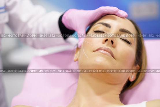 Doctor painting the area of a middle-aged woman’s face where the PDO suture treatment threads will be injected.. Doctor painting the area of a woman’s face where the PDO suture treatment threads will be injected. Стоковое фото, агентство Ingram Publishing / Фотобанк Лори