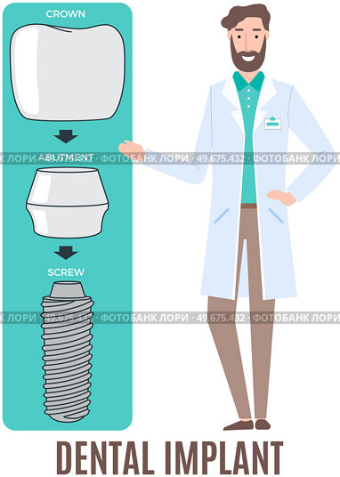 Doctor talking about dental prosthesis structure. Implantation dentistry, stomatology. Tooth care, treatment. Dental implant creation scheme. Sequence of connection of screw, abutment and crown. Doctor talking about prosthesis structure. Dentist works with dental implant creation scheme. Стоковая иллюстрация, агентство Ingram Publishing / Фотобанк Лори