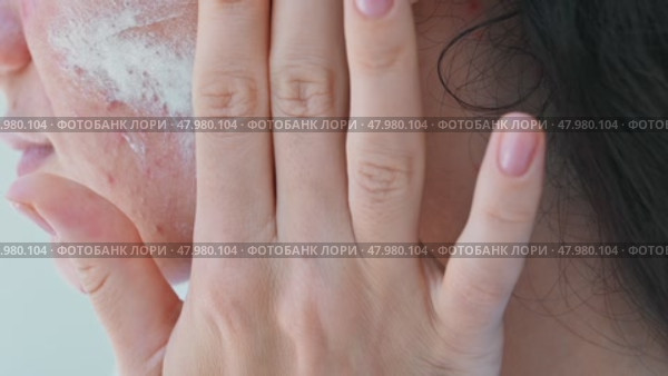 Face, cream and a woman with skin care. Problematic skin of a young girl in close-up. Pimples, acne, pores, scars. Genuine leather without filters. Стоковое видео, видеограф Корчагина Анастасия / Фотобанк Лори