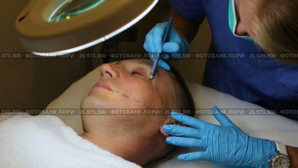 Female doctor is preparing patient for procedure with using marker in estetic clinic. Стоковое видео, видеограф Яков Филимонов / Фотобанк Лори