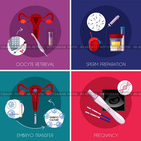 Four squares flat in vitro fertilization IVF icon set with oocytr retrieval sperm preparation embryo transfer and pregnancy descriptions vector illustration. Стоковая иллюстрация, агентство Ingram Publishing / Фотобанк Лори