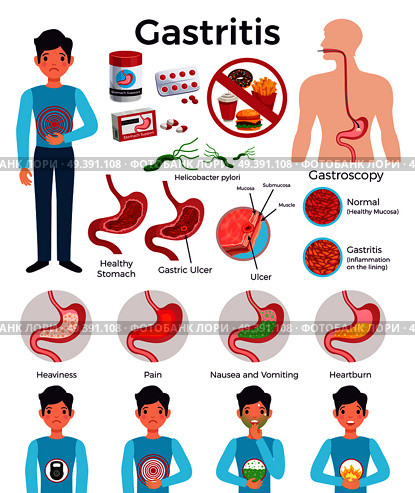 Gastritis Infographic Elements Set. Стоковая иллюстрация, агентство Ingram Publishing / Фотобанк Лори