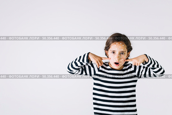 girl with rush pointing face. Стоковое фото, агентство Ingram Publishing / Фотобанк Лори