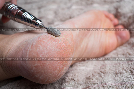Hardware pedicure for yourself, chiropody and podology concept, foot care. Стоковое фото, фотограф Станислав Тарко / Фотобанк Лори