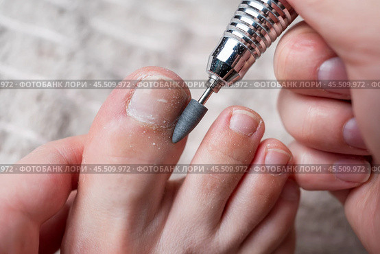 Hardware pedicure for yourself, ingrown toenail, chiropody and podology concept, foot care. Стоковое фото, фотограф Станислав Тарко / Фотобанк Лори