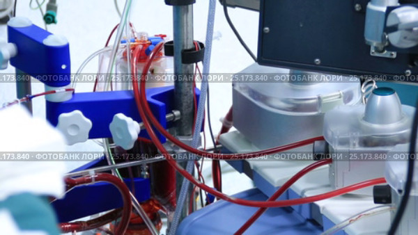 Heart lung machine for heart surgery. Стоковое видео, видеограф Швец Анастасия / Фотобанк Лори