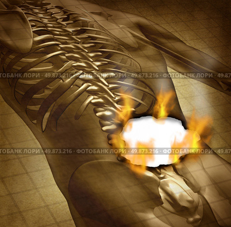 Human burning back pain and backache medical concept with a grunge old document of an upper torso body skeleton with the spine and vertebral column being burnt with fire flames and smoke as a health care symbol for spinal problems. Стоковое фото, агентство Ingram Publishing / Фотобанк Лори