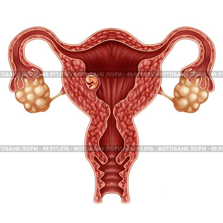 Implanted human embryo concept and successful pregnancy implantation in the uterus as a growing fetus in a female body as an obstetrics and gynecology symbol with 3D illustration elements. Стоковое фото, агентство Ingram Publishing / Фотобанк Лори