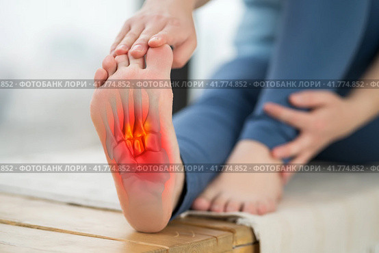 Joint diseases, hallux valgus, plantar fasciitis, heel spur, woman's leg hurts, pain in the foot, massage of female feet at home. Стоковое фото, фотограф Станислав Тарко / Фотобанк Лори