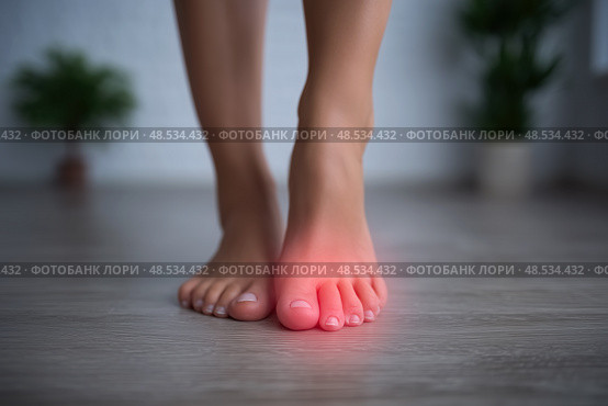Joint diseases, hallux valgus, plantar fasciitis, woman's leg hurts, pain in the foot, female feet closeup, health problems concept. Стоковое AI-изображение, AI-художник Станислав Тарко / Фотобанк Лори