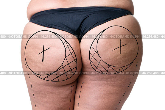 Liposuction, fat and cellulite removal concept, overweight female body with painted lines and arrows. Стоковое фото, фотограф Станислав Тарко / Фотобанк Лори