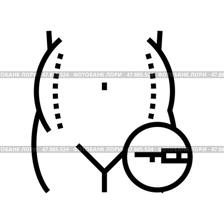 liposuction surgery line icon vector illustration. Стоковая иллюстрация, иллюстратор Vectorwin / Фотобанк Лори
