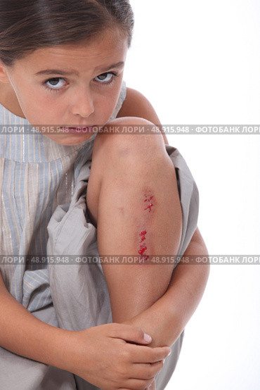 Little girl with grazed knee. Стоковое фото, агентство Ingram Publishing / Фотобанк Лори