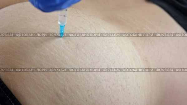 Needle injecting into the muscle. Nurse doing a trigger point injection in patient back. Close up doctor makes an shot therapy. Alternative pain treatment. Covid-19, pox, MPOX, flu virus vaccine. Стоковое видео, видеограф Марина Демидюк / Фотобанк Лори
