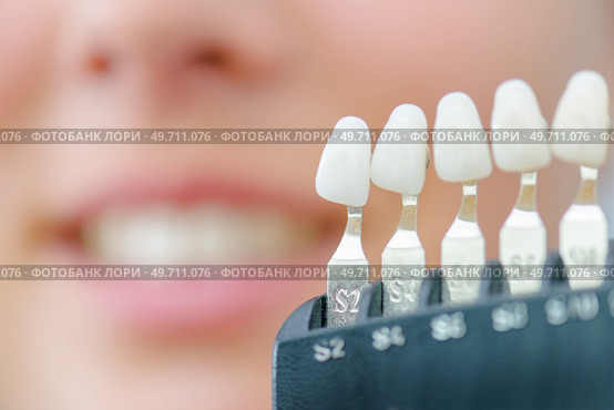 Numbered individual false teeth for colour match. Стоковое фото, агентство Ingram Publishing / Фотобанк Лори