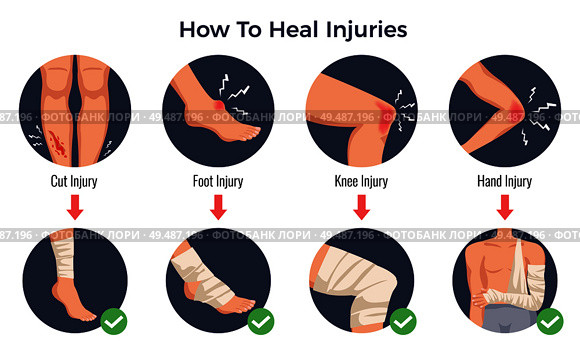 Open cut wounds knee elbow bruises foot injury treatments concept round flat icons bandage applications vector illustration. Стоковая иллюстрация, агентство Ingram Publishing / Фотобанк Лори