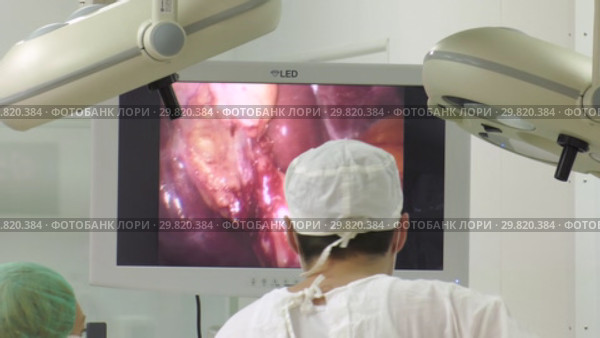 Операционная. Врач проводит хирургическую операцию. Surgery. The doctor performs surgery. Стоковое видео, видеограф Евгений Романов / Фотобанк Лори