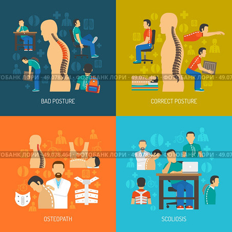 Posture 2x2 Design Concept Set . Posture 2x2 flat design concept set of people with scoliosis osteopath with  patient and corrective orthopedic products vector illustration . Стоковая иллюстрация, агентство Ingram Publishing / Фотобанк Лори
