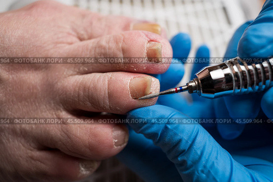 Professional hardware pedicure, ingrown toenail, elderly woman with cracked skin on her foot at a podiatrist's appointment, chiropody and podology concept. Стоковое фото, фотограф Станислав Тарко / Фотобанк Лори