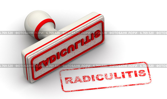 Радикулит (radiculitis). Печать и оттиск. Стоковая иллюстрация, иллюстратор WalDeMarus / Фотобанк Лори