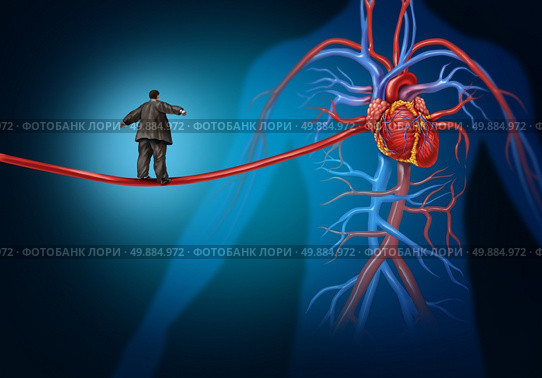 Risk factors for heart disease danger as a medical health care lifestyle concept with an overweight person walking on an elongated artery highwire as a symbol for coronary illness hazard or high blood pressure. . Стоковое фото, агентство Ingram Publishing / Фотобанк Лори