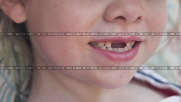 Рот ребенка без двух верхних молочных зубов крупным планом. Беззубая улыбка девочки 6-7 лет. Уход за молочными зубами. Отсутствующие зубы. Стоковое видео, видеограф Воловодов Владимир / Фотобанк Лори