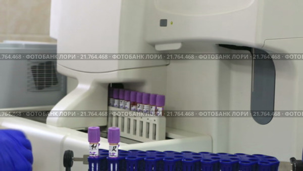 Современный высокопроизводительный автоматический гематологический анализатор с автопогрузчиком. Стоковое видео, видеограф Юлия Машкова / Фотобанк Лори