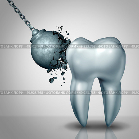 Strong tooth enamel and teeth strength dental or dentistry  symbol as awrecking ball being demolished by a solid white molar as a medicine concept as a 3D render. Стоковое фото, агентство Ingram Publishing / Фотобанк Лори