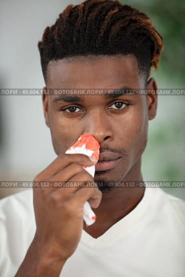 young man touching his bleeding nose. Стоковое фото, агентство Ingram Publishing / Фотобанк Лори
